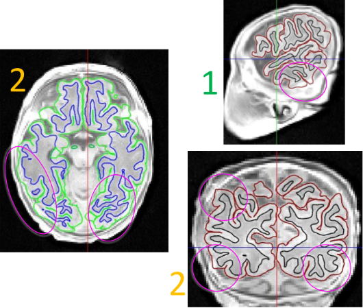 Non-Brain Tissue Images