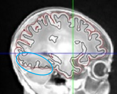 Overlap Image