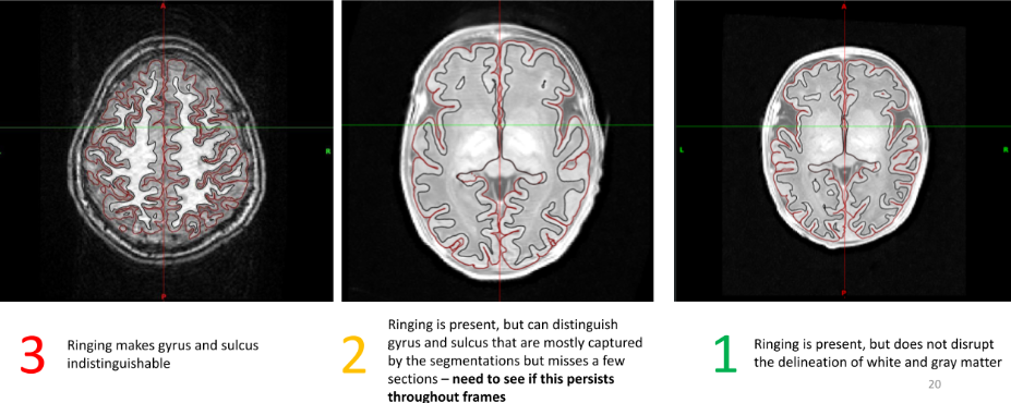 Ringing Image